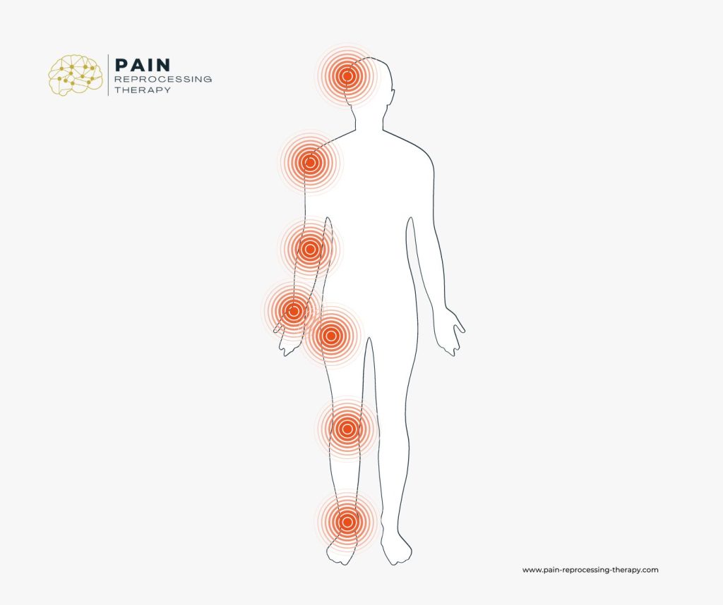 neuroplastic pain one-sided